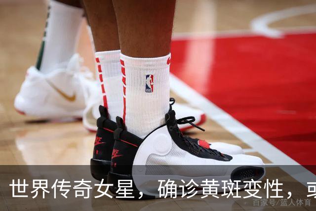 世界传奇女星，确诊黄斑变性，或将告别舞台